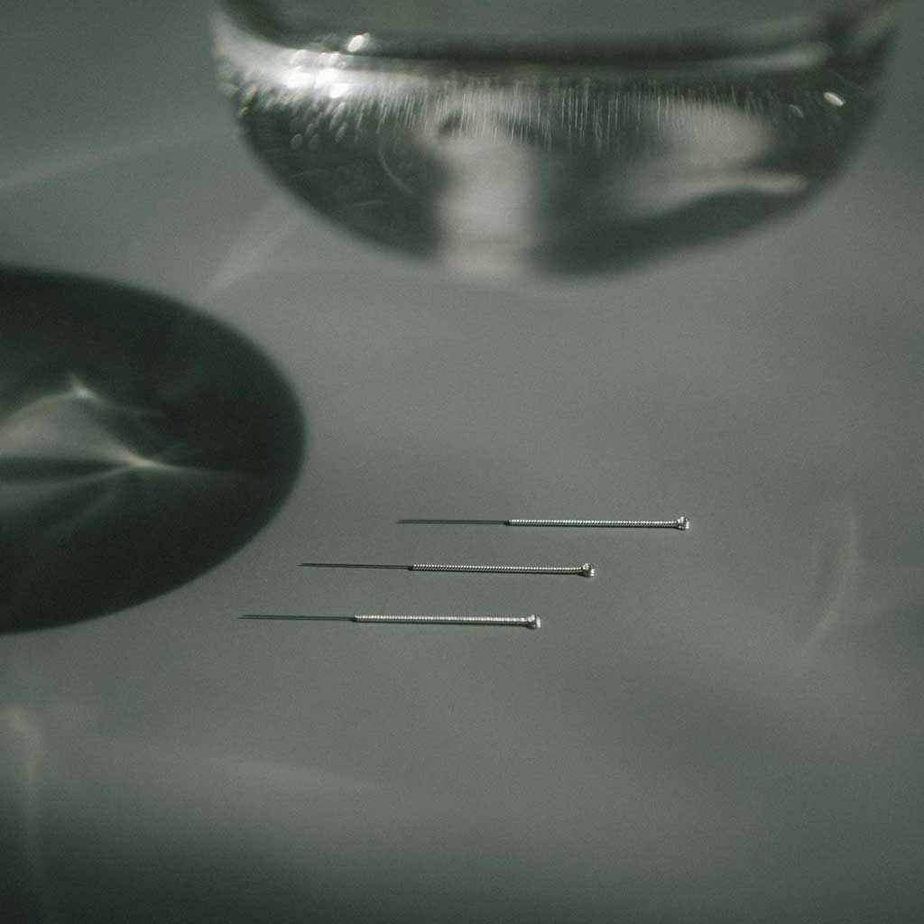 10 Week Acupuncture series