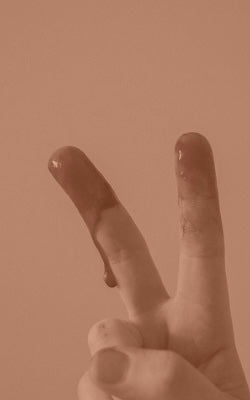 To Bleed Or Not To Bleed, That Is The Question!