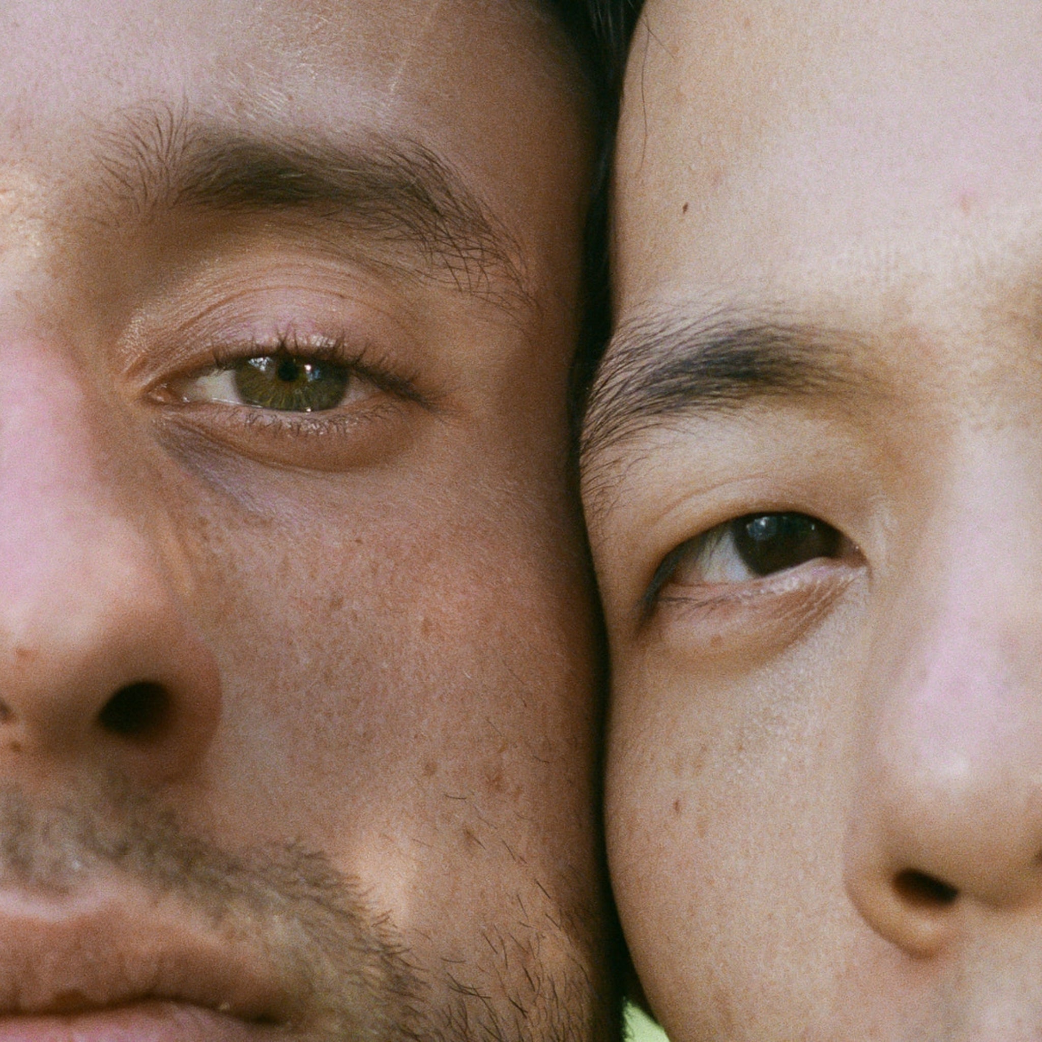 WARNING!!! Check your Moles (Graphic images) #Safetyinbeauty