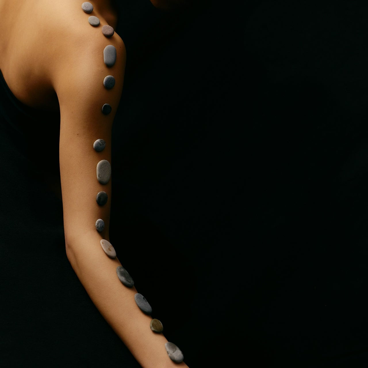 What is Keratosis Pilaris